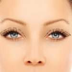 eyelid-surgery-med